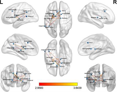 Differences in Brain Functional Networks of Executive Function Between Cantonese-Mandarin Bilinguals and Mandarin Monolinguals